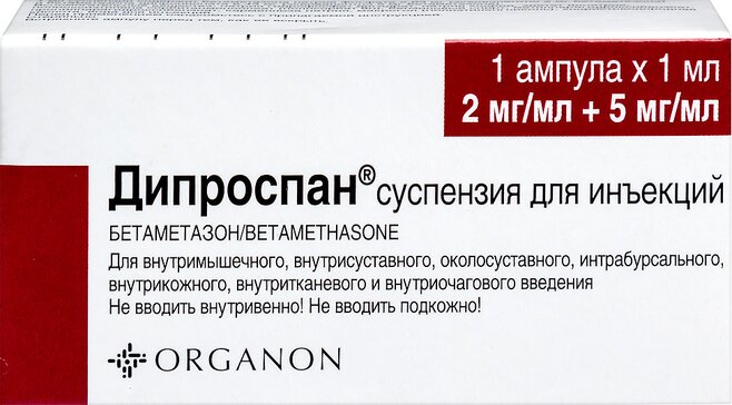 Заболевания тазобедренного сустава. Эндопротезирование