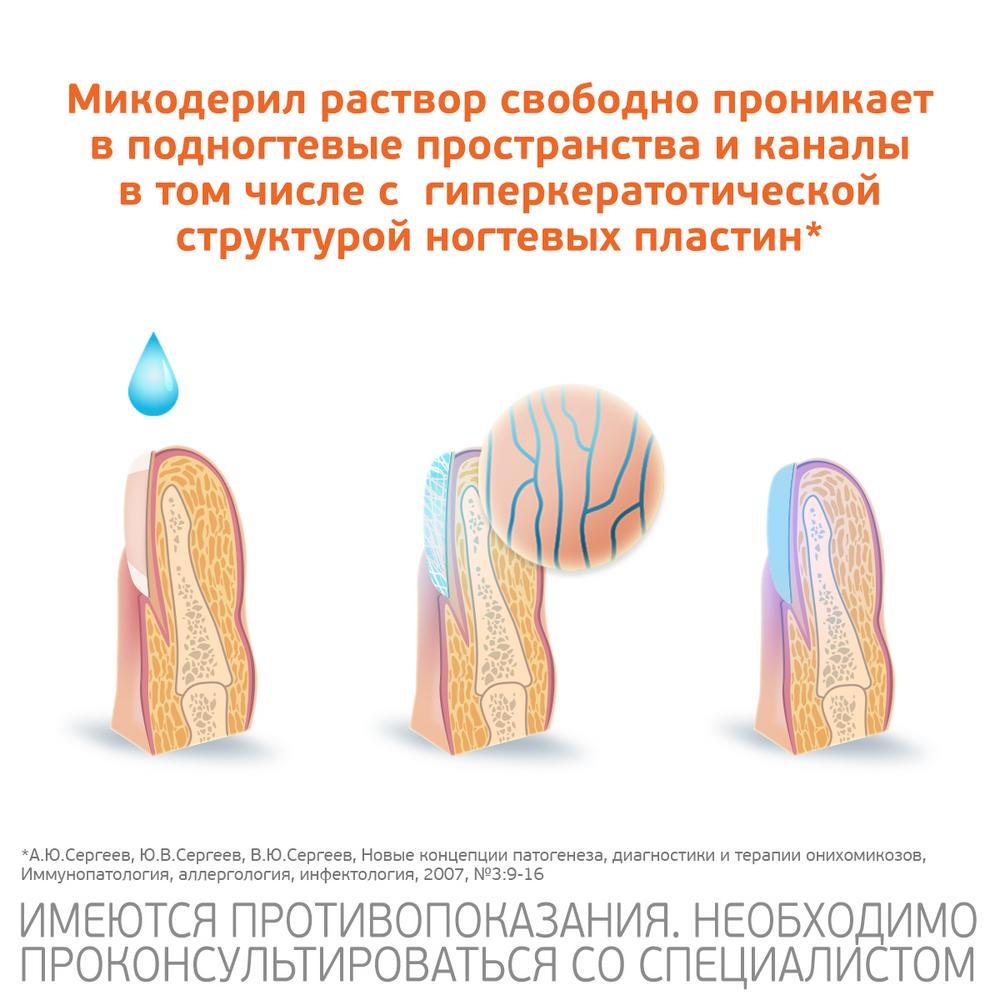 Микодерил От Грибка Цена